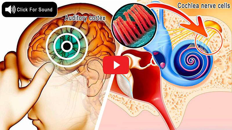 natural tinnitus solution - Click here to watch a video about how to use a simple method to silence ear buzzing.